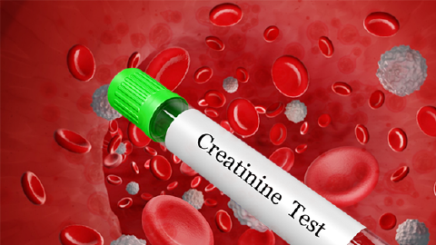 Featured Image for Creatinine Clearance Calculator